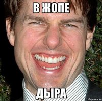 В жопе Дыра