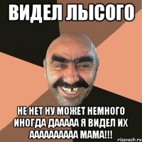 видел лысого не нет ну может немного иногда дааааа я видел их аааааааааа мама!!!