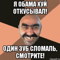 Я Обама хуй откусывал! Один зуб сломаль, смотрите!