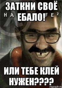 заткни своё ебало! или тебе клей нужен????