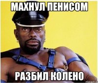 махнул пенисом разбил колено