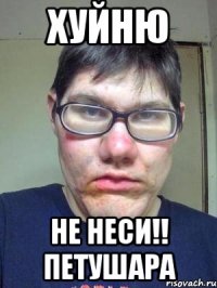 хуйню не неси!! петушара