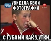 увидела свои фотографии с губами как у утки