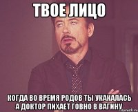 Твое лицо когда во время родов ты укакалась а доктор пихает говно в вагину