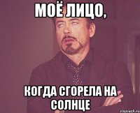 Моё лицо, когда сгорела на солнце