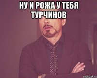 Ну и рожа у тебя турчинов 