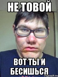 Не товой Вот ты и бесишься