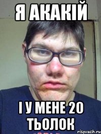 Я АКАКІЙ І У МЕНЕ 20 ТЬОЛОК