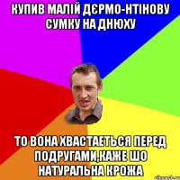 Купив малій ДЄРМО-нтінову сумку на днюху то вона хвастаеться перед подругами,каже шо натуральна крожа