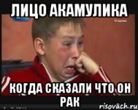 Лицо Акамулика когда сказали что он рак
