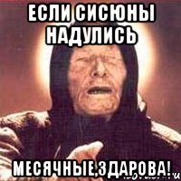 если сисюны надулись месячные,здарова!
