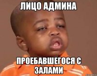 Лицо админа Проебавшегося с залами