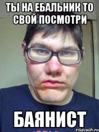 ты на ебальник то свой посмотри баянист