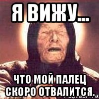 Я вижу... Что мой палец скоро отвалится.