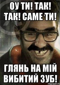 Оу ти! Так! Так! Саме ти! Глянь на мій вибитий зуб!