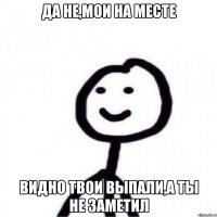 Да не,мои на месте видно твои выпали,а ты не заметил