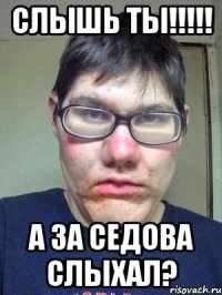 Слышь ты!!!!! А за Седова слыхал?