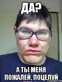 ДА? А ТЫ меня пожалей, ПОЦЕЛУЙ