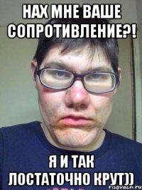 НаХ Мне ваше сопротивление?! Я и так лостаточно крут))