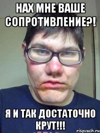 НаХ мне ваше сопротивление?! Я и так достаточно крут!!!