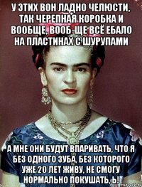 У этих вон ладно челюсти, так черепная коробка и вообще, вооб-ще всё ебало на пластинах с шурупами А мне они будут впаривать, что я без одного зуба, без которого уже 20 лет живу, не смогу нормально покушать, Ь!