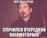 моё лицо когда случился очередной пневмоторакс