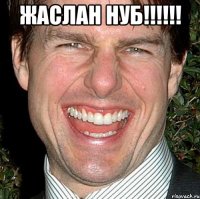 Жаслан НУБ!!!!!! 