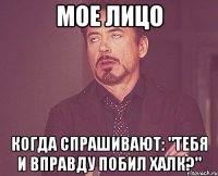 Мое лицо Когда спрашивают: "Тебя и вправду побил Халк?"