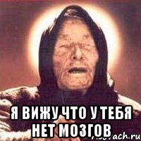  я вижу что у тебя нет мозгов