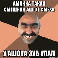 Аминка такая смешная аш от смеха У Ашота зуб упал