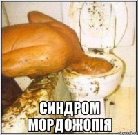  Синдром мордожопія