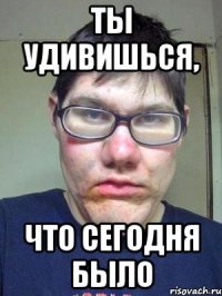 Ты удивишься, что сегодня было