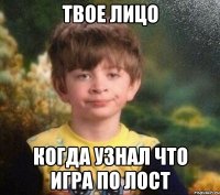 твое лицо когда узнал что игра по лост