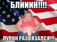 Блииин!!!! Пупок развязался!!!