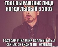 твое выражение лица когда Лысый в 2002 году сам учил меня взламывать, а сейчас он видите ли - Отупел!!!