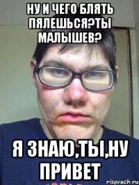 ну и чего блять пялешься?Ты малышев? я знаю,ты,ну привет