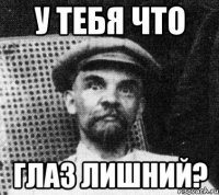 у тебя что глаз лишний?