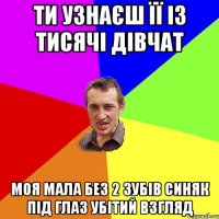 Ти узнаєш її із тисячі дівчат моя мала без 2 зубів синяк під глаз убітий взгляд