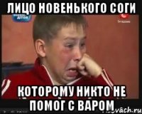 Лицо новенького соги Которому никто не помог с варом