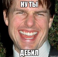 ну ты дебил