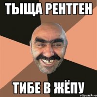 Тыща рентген тибе в жёпу