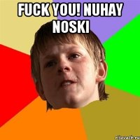 Fuck you! Nuhay noski 