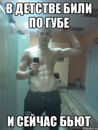 В ДЕТСТВЕ БИЛИ ПО ГУБЕ И СЕЙЧАС БЬЮТ