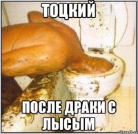 тоцкий после драки с лысым