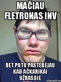 mačiau fletronas inv bet poto pastebėjau kad ačkarikai užrasoje