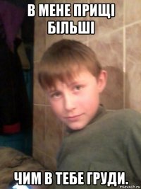 в мене прищі більші чим в тебе груди.