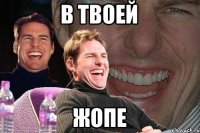 В ТВОЕЙ ЖОПЕ