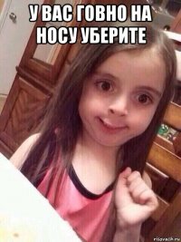 у вас говно на носу уберите 