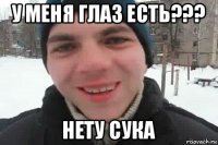 у меня глаз есть??? нету сука