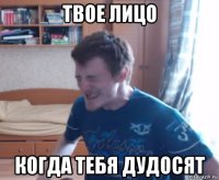 твое лицо когда тебя дудосят